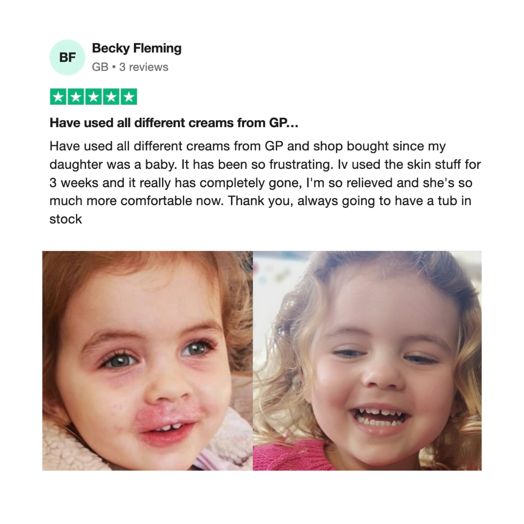 Skin Stuff 50ml – Soothe, Calm & Restore - BUY 1 GET 1 FREE TODAY!!!