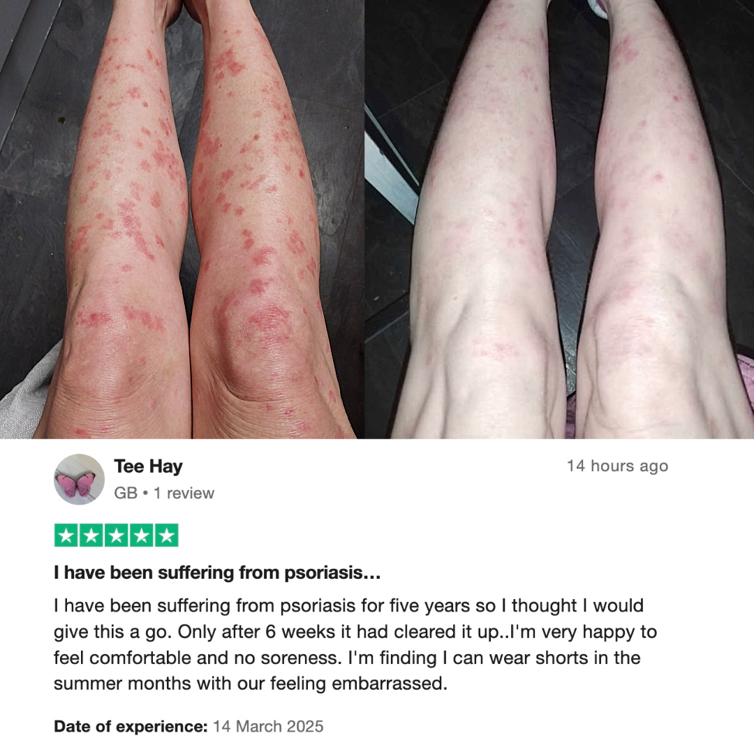 Skin Stuff 50ml – Soothe, Calm & Restore - BUY 1 GET 1 FREE TODAY!!!