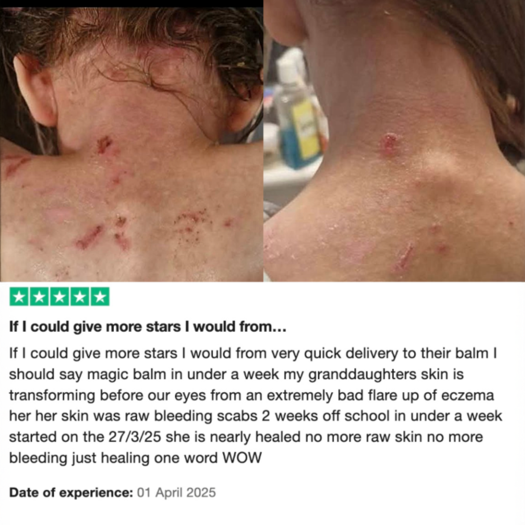 Skin Stuff 50ml – Soothe, Calm & Restore - BUY 1 GET 1 FREE TODAY!!!