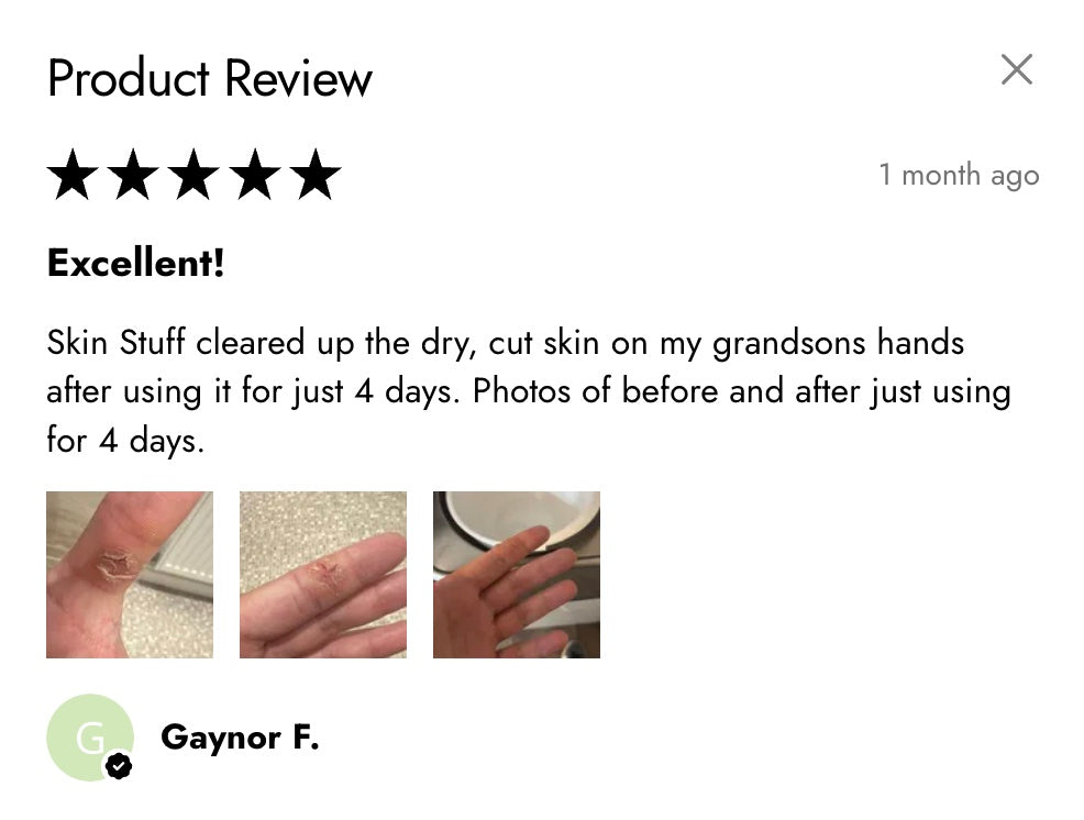 Skin Stuff Intensive Body Balm 50ml – Buy One Get One Free | Soothes Dry, Itchy & Irritated Skin