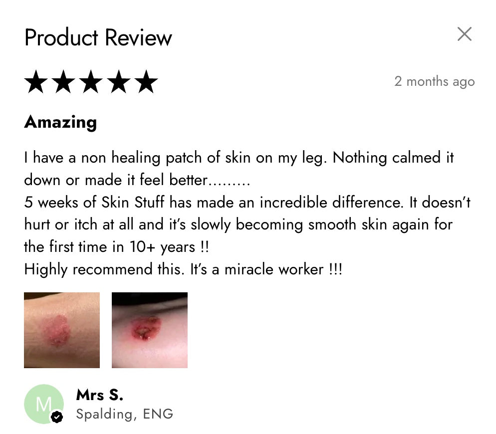 Skin Stuff Intensive Body Balm 50ml – Buy One Get One Free | Soothes Dry, Itchy & Irritated Skin